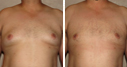 Before & After Photos